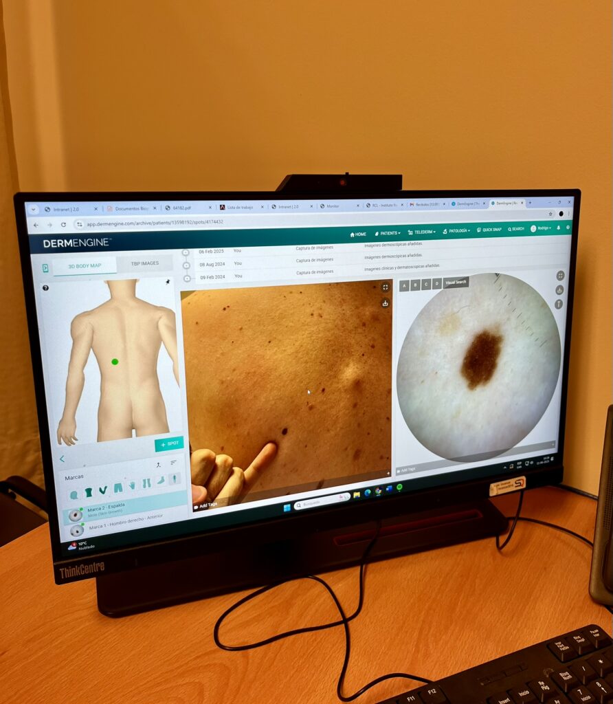 Tecnología al servicio de las personas en el Día Mundial del Cáncer de Piel